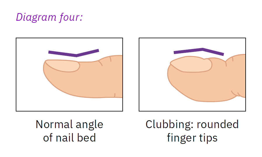 Nail bed diagram